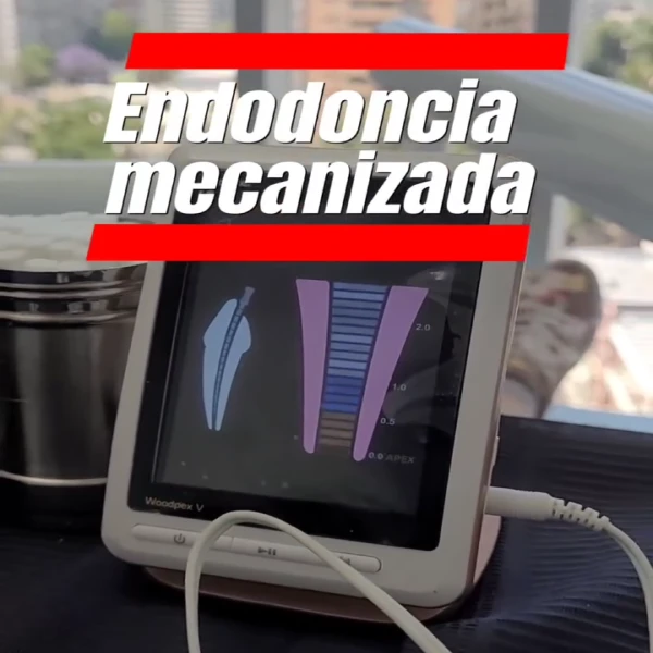Endodoncia